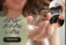 سریع ترین روش درمان ریزش مو
