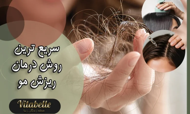 سریع ترین روش درمان ریزش مو