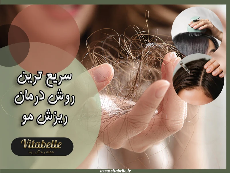 سریع ترین روش درمان ریزش مو
