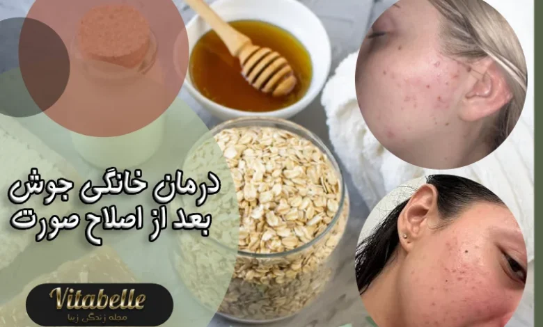 درمان خانگی جوش بعد از اصلاح صورت | روش های سریع و ساده